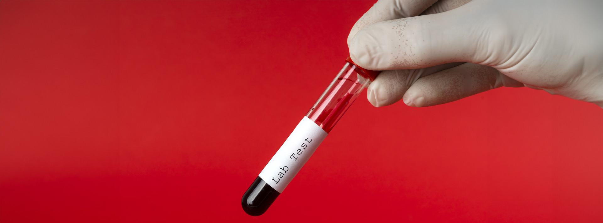 Λήψη Εμβρυικού Αίματος