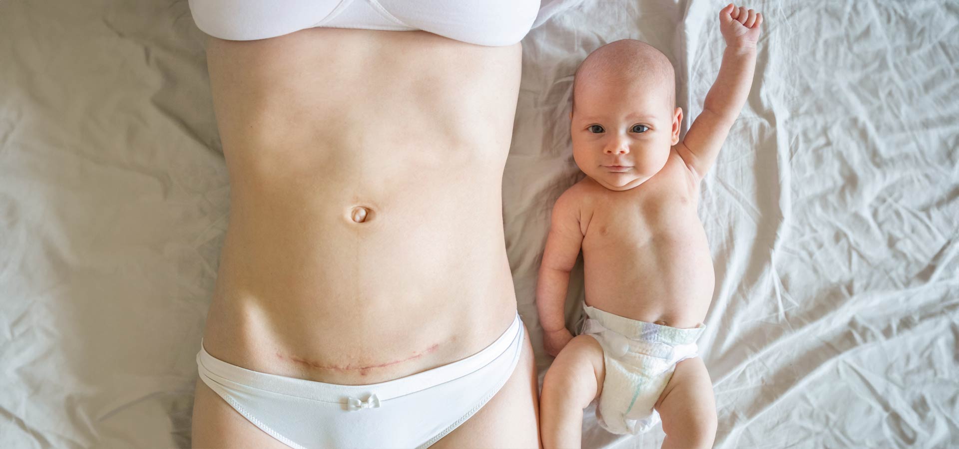 Τοκετός μετά από Καισαρική Τομή (VBAC)